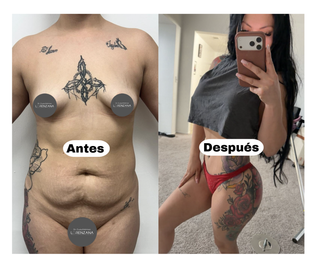 Mommy Makeover: Una transformación para tu vida